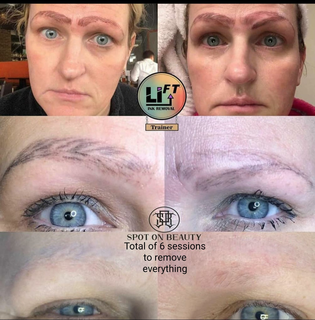 Teryn&#39;s Li-FT Lightening Starter Kit