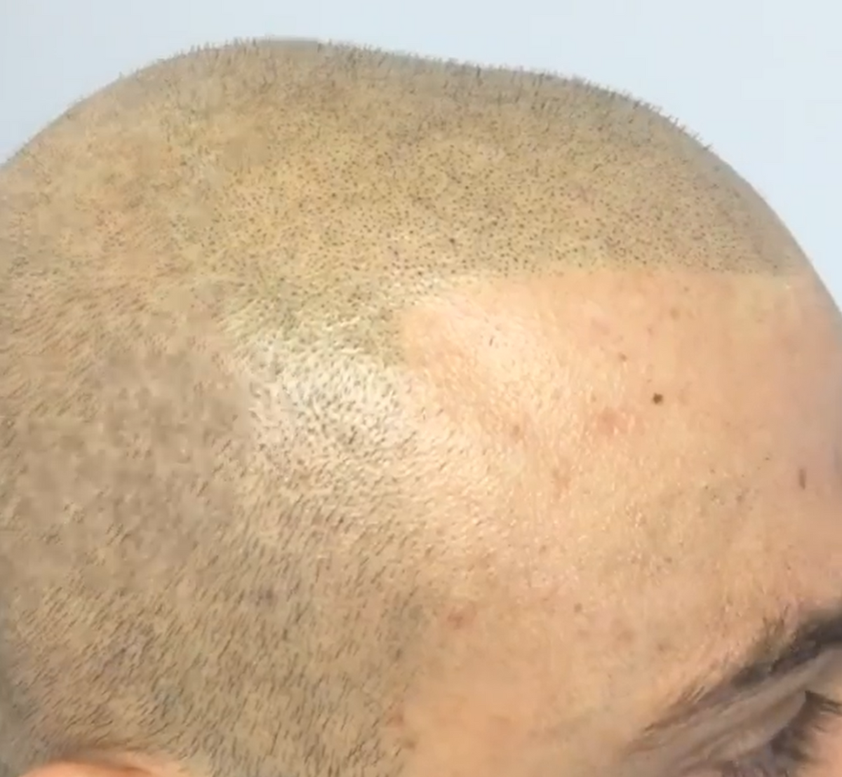 Li Pigments Li Scalp - Pumpkin 15ml