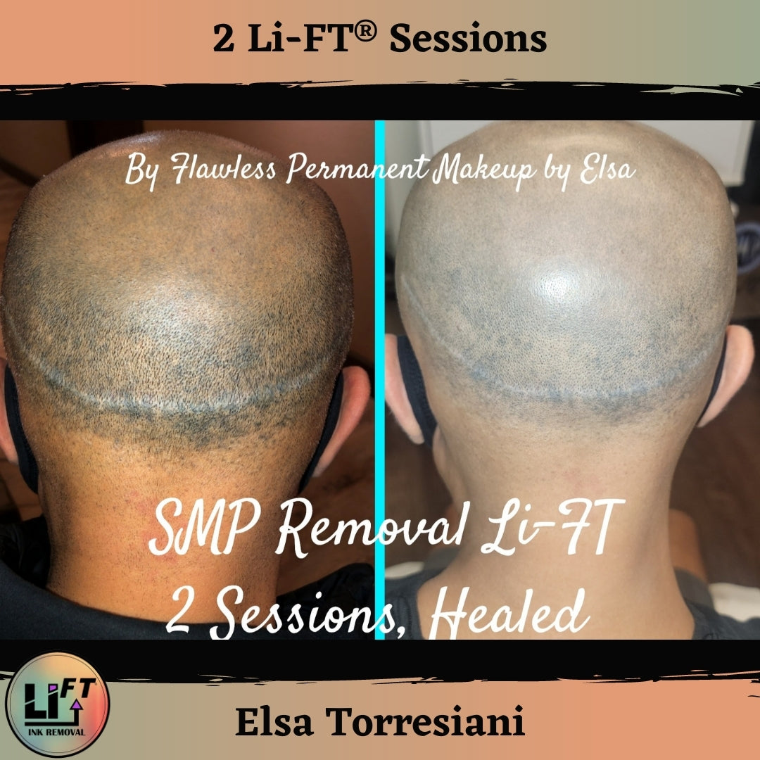 Teryn&#39;s Li-FT Lightening Starter Kit