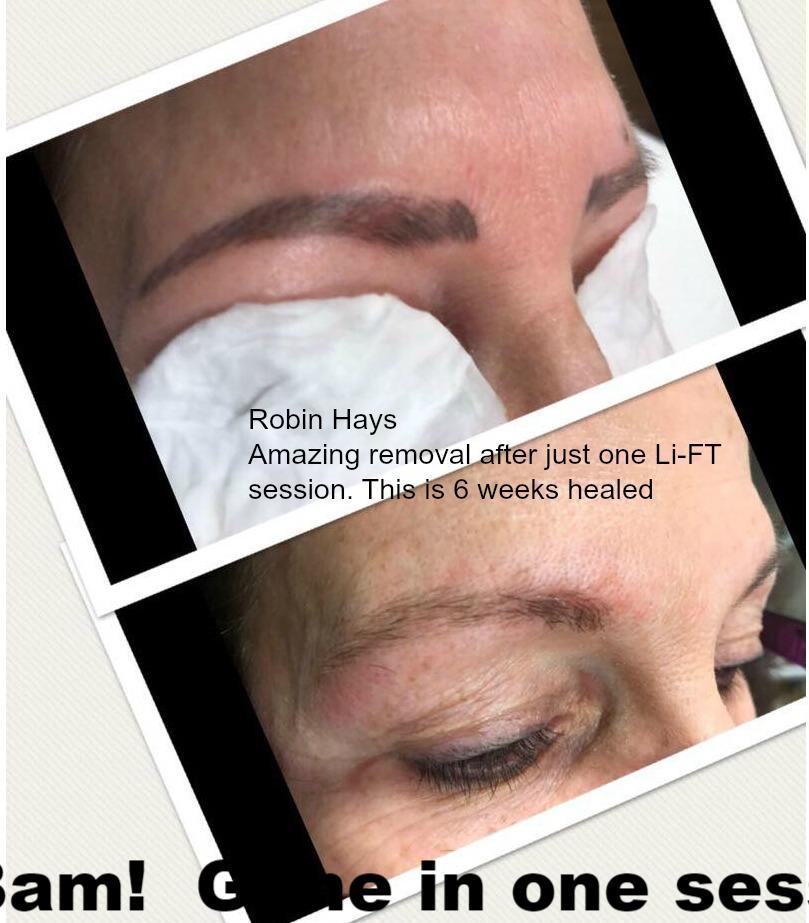 Li Pigments Li-FT - Pigment Lightening Solution 15ml