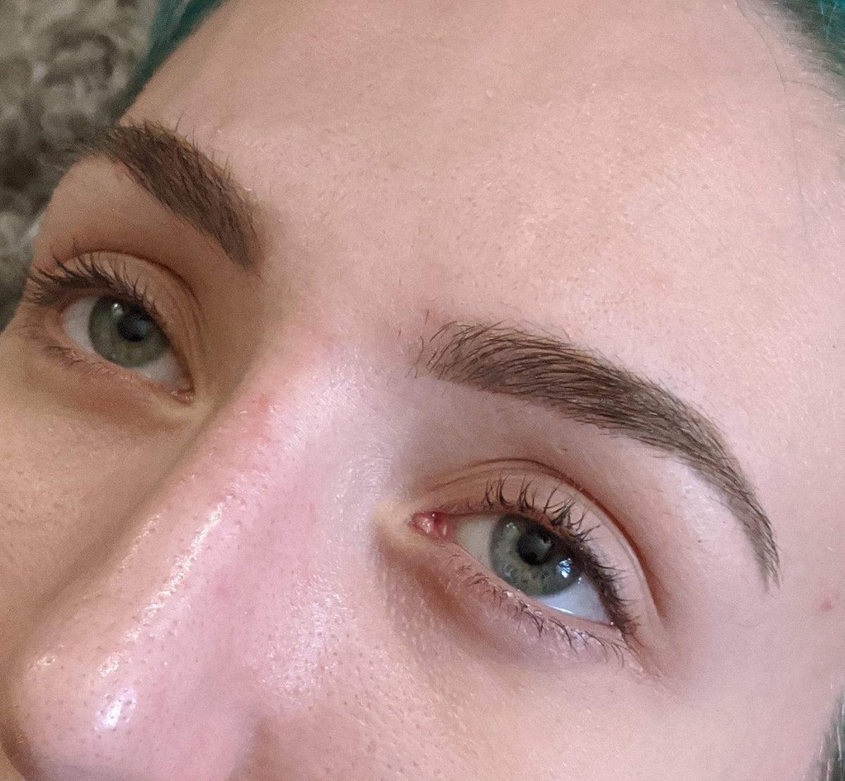 Sage healed one session single needle